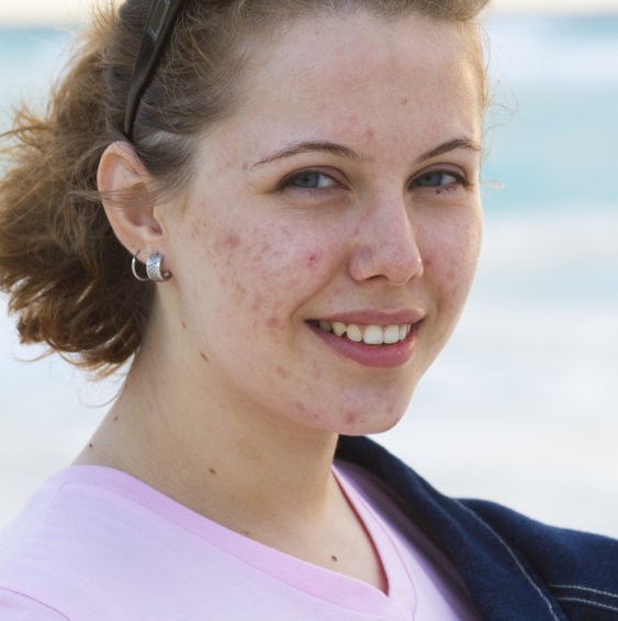 Young woman watching sunrise.